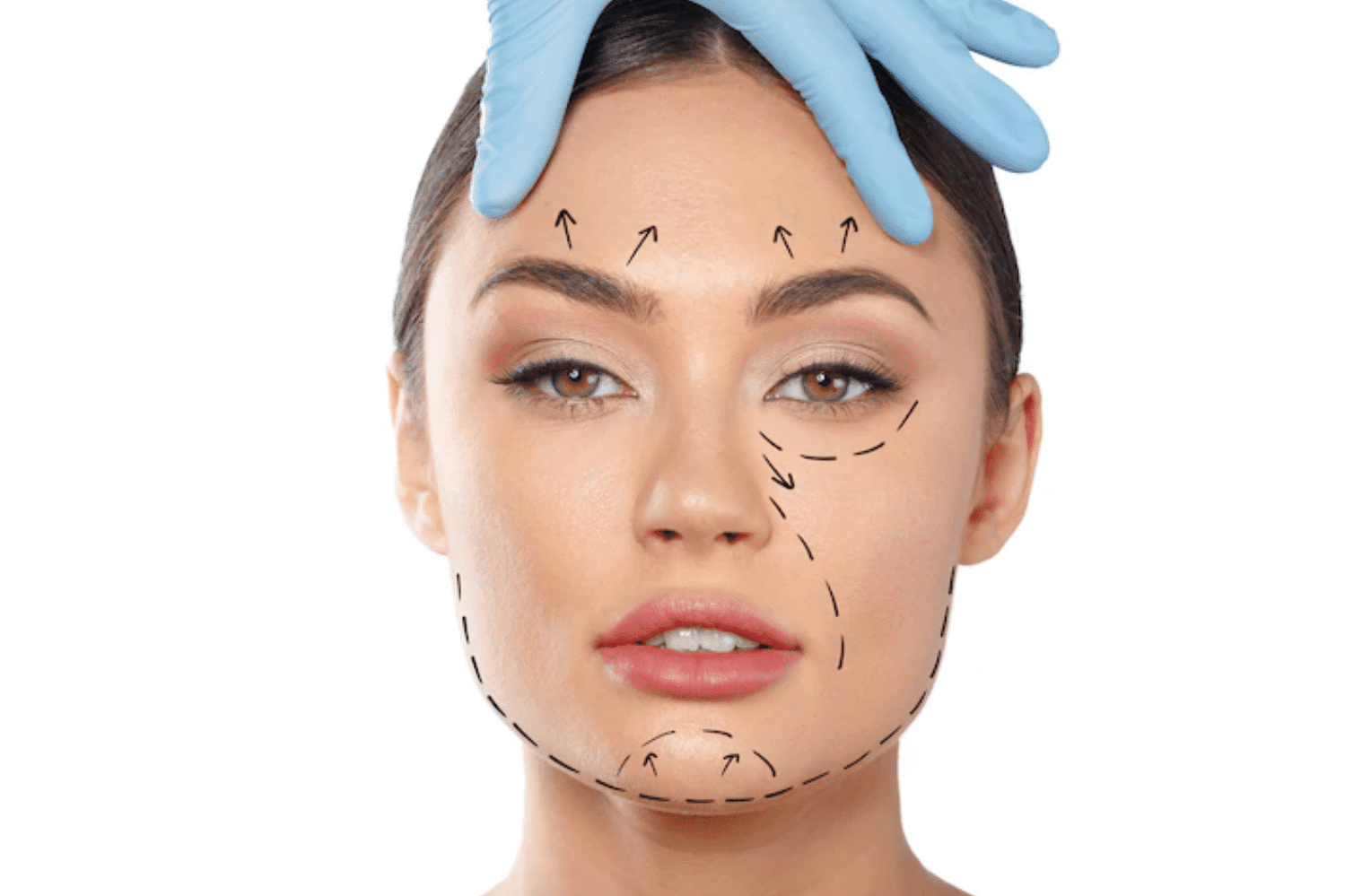 Blefaroplastia: o que é e para quem é indicado