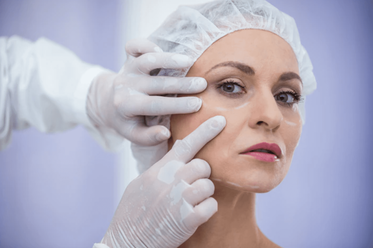 Diferenças entre a blefaroplastia clássica e estruturada