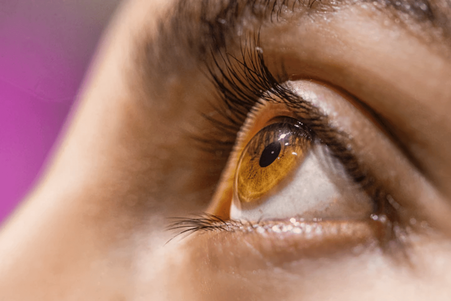 Olhos proeminentes: o que é, causas, sintomas e como tratar